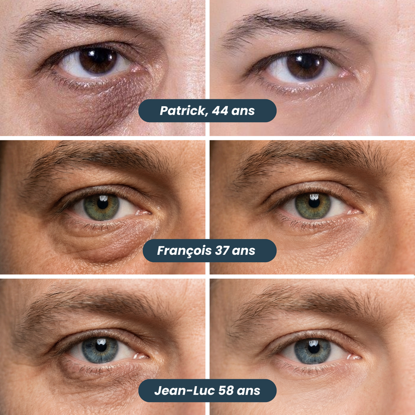 Neo Patchs Anti-Cernes Nouvelle Génération