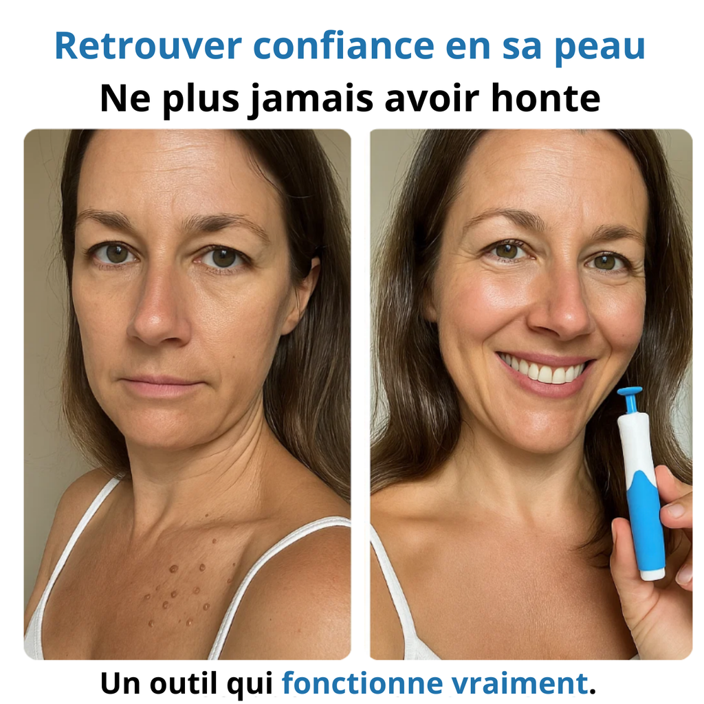PACK ALPROMED™ - Une peau lisse en seulement 4 jours