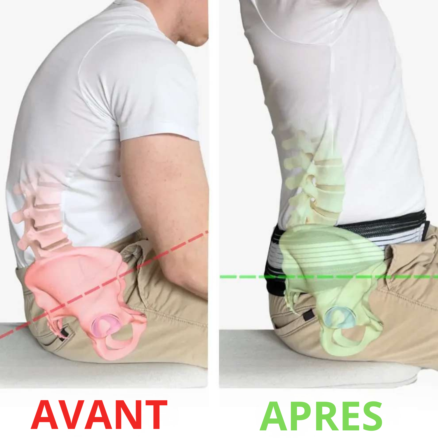 Ceinture orthopédique - Orthomed